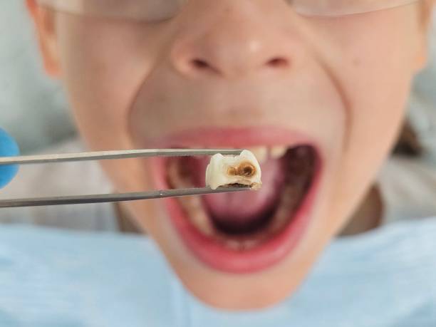 Best Walk-In Emergency Dentist in Stafford Courthouse, VA